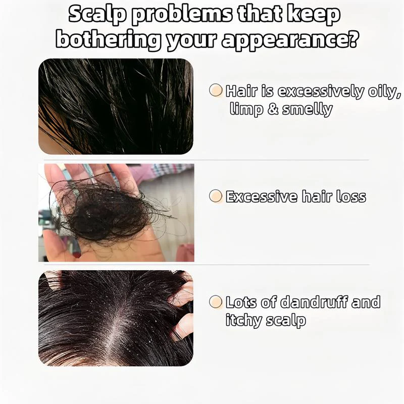 Anti Hair Fall - Image 3