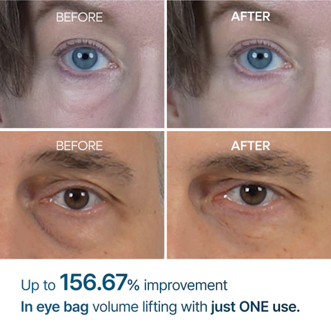 Eloria Eyephalt Eye Cream - Image 4