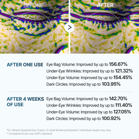 Eloria Eyephalt Eye Cream - Image 5