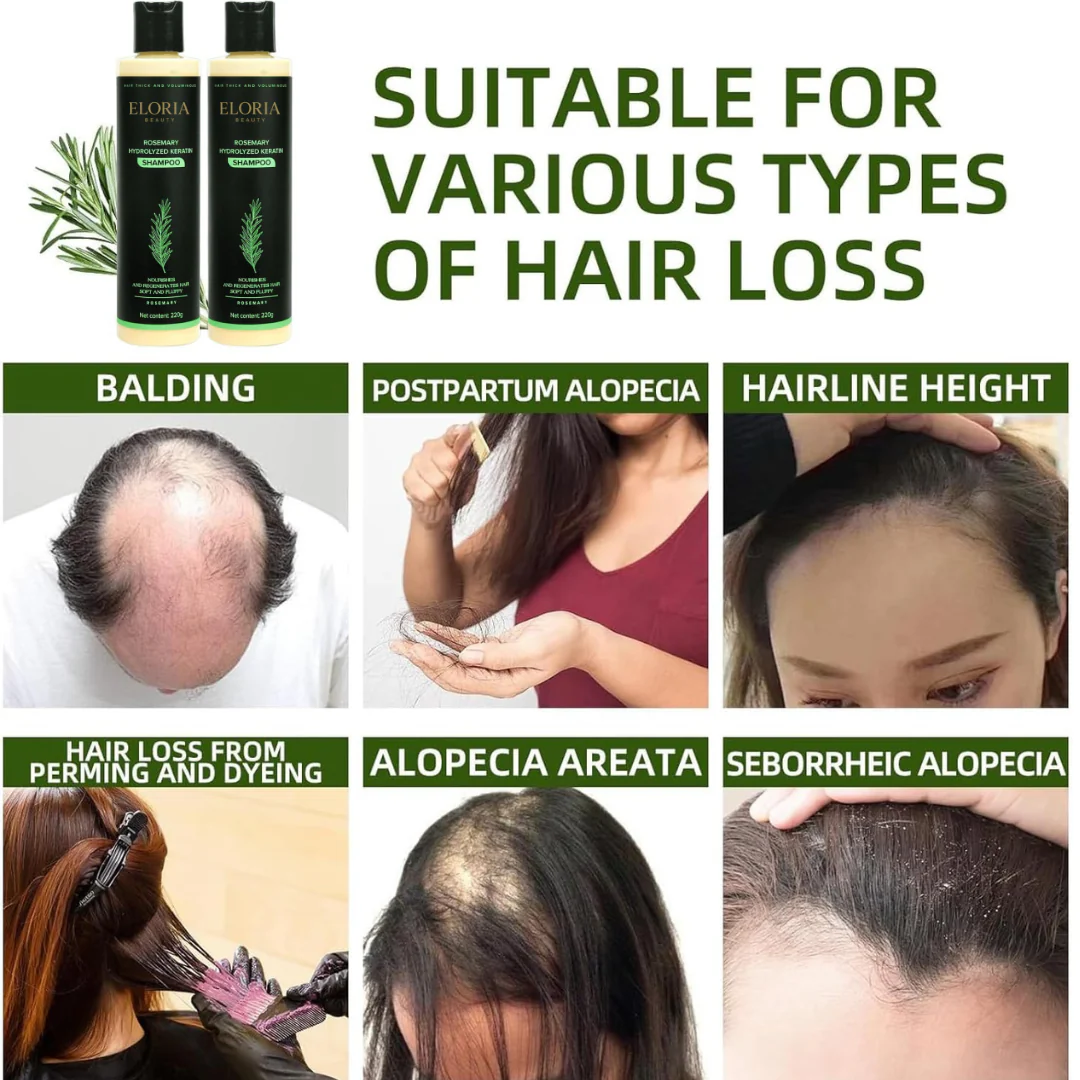 Organic Rosemary Hair Growth Shampoo - Image 3