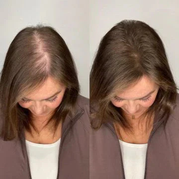 Organic Rosemary Hair Growth Shampoo - Image 8